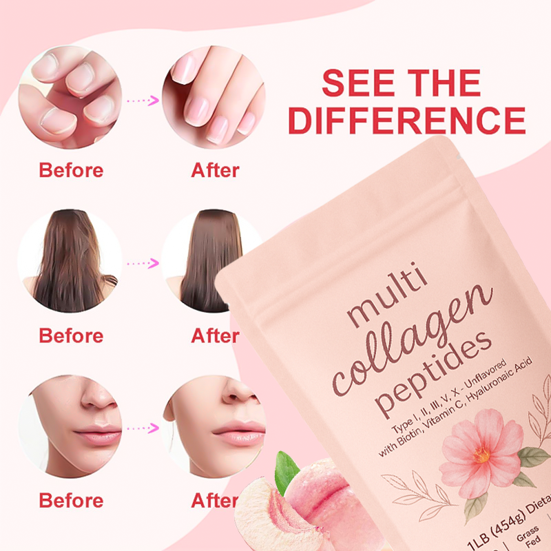 主图_03 READY TO SHIP Multi Collagen Supplement Powder Support Custom Dietary Supplement Hyaluronic Acid Vitamin C Kollagen Collagen Powder - 图片 6